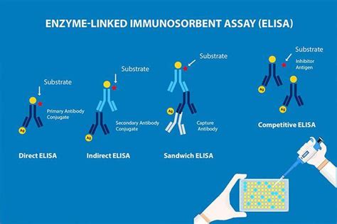 elisa hiv test